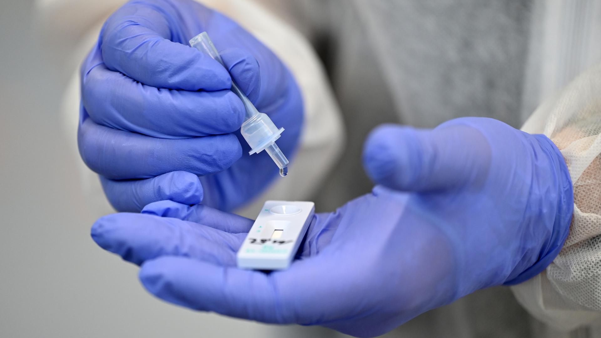 3.099 nouvelles contaminations au covid sont dépistées en moyenne par jour en Belgique.