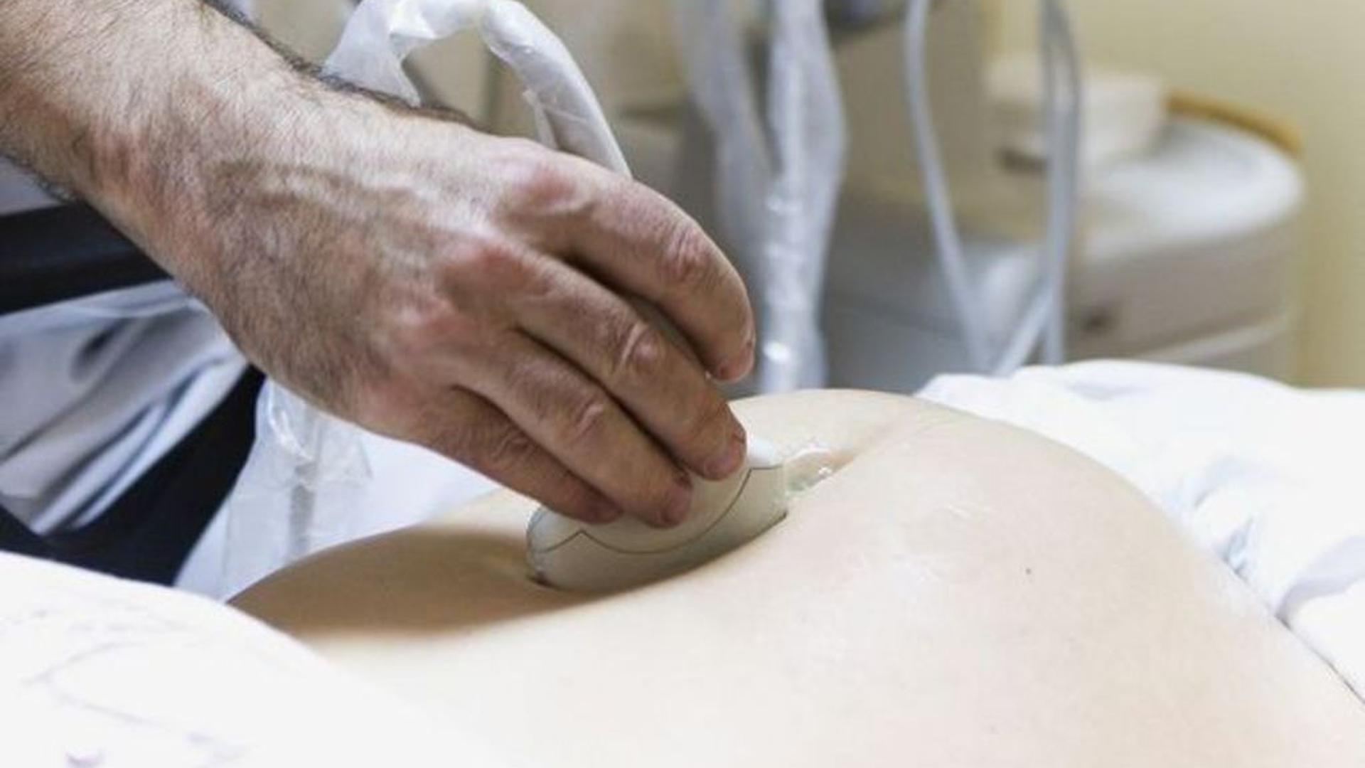 Le rapport d'un comité scientifique belge recommande une prolongation du délai d'IVG jusqu’à 18 semaines post-conception.