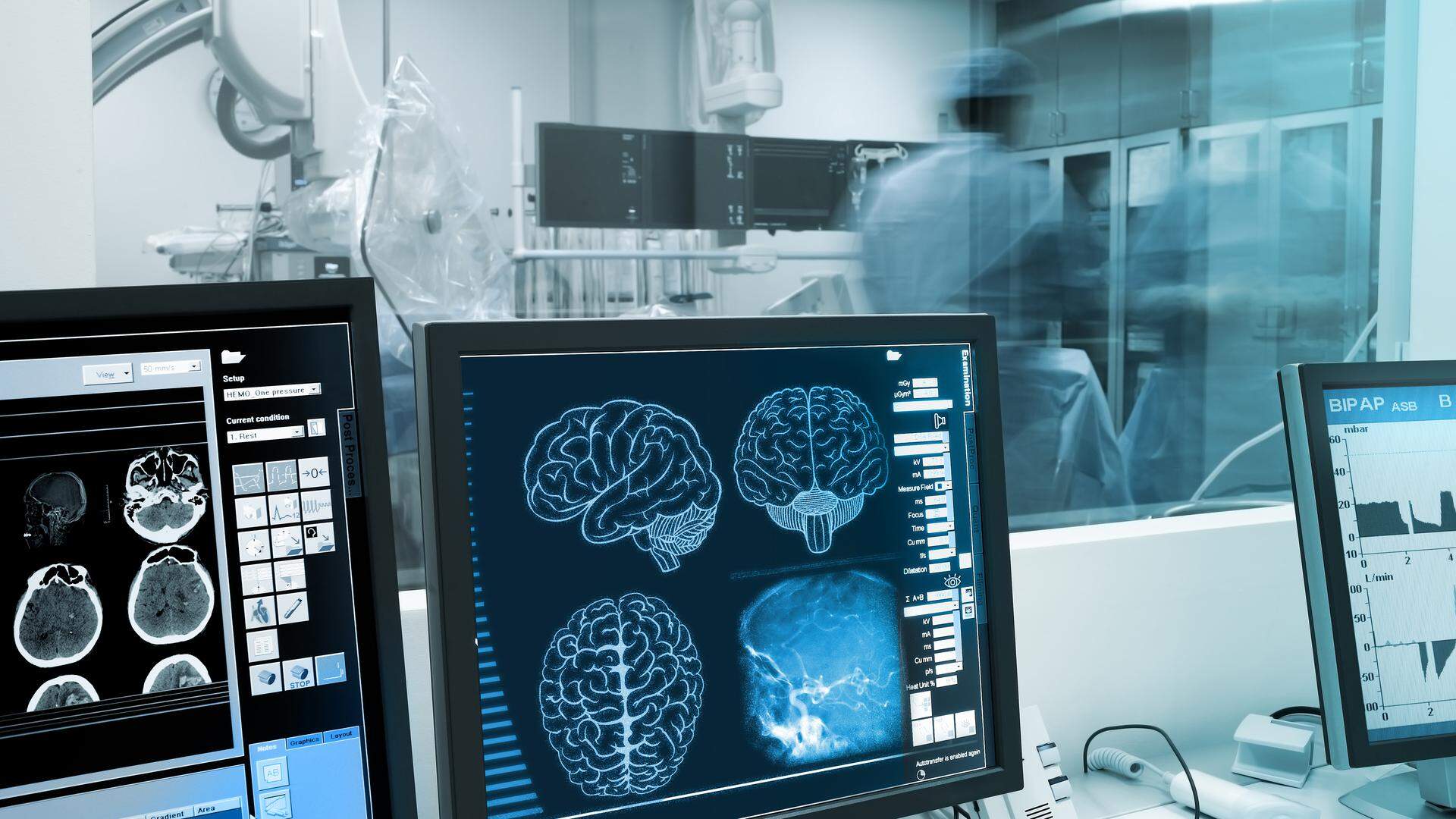 Les maladies neurodégénératives touchent plus de 33 millions de personnes dans le monde, dont des milliers au Luxembourg. 