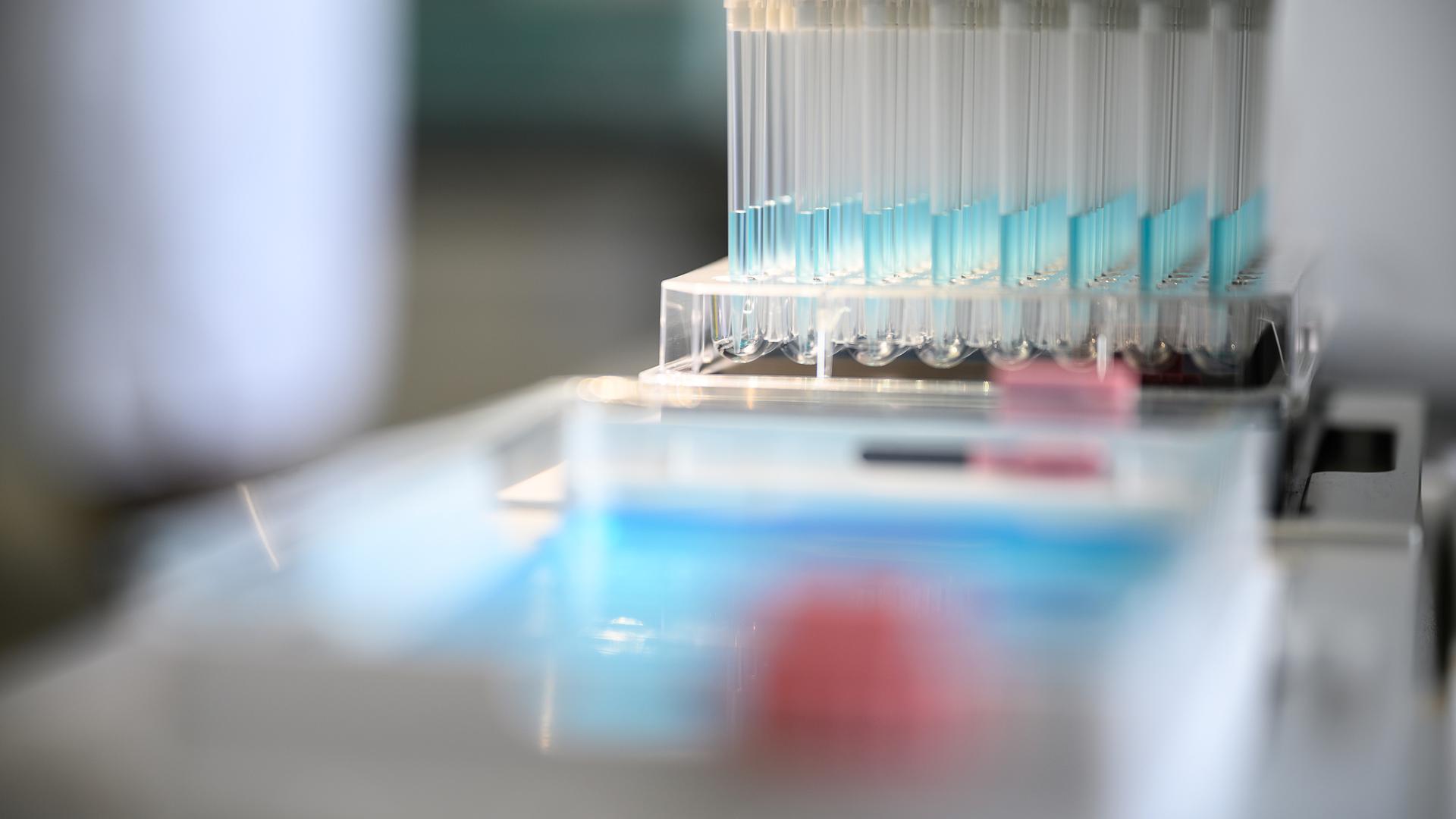 Le Laboratoire national de santé va améliorer son outil de séquençage pour analyser plus d'échantillons, plus vite.