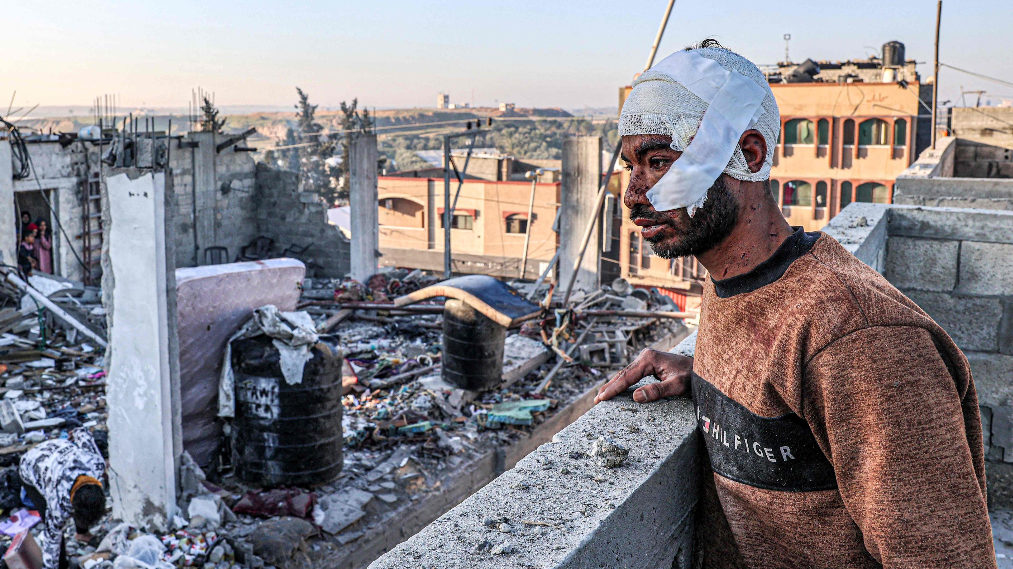 TOPSHOT - An injured man with a bandaged head looks on while standing next to the rubble and debris of a destroyed building in the aftermath of Israeli bombardment on Rafah in the southern Gaza Strip on February 7, 2024, amid the ongoing conflict between Israel and the Palestinian militant group Hamas. (Photo by SAID KHATIB / AFP)